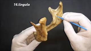 Anatomy Of The Mandible Bone Ll On Natural Mandible