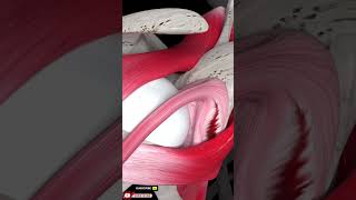 Fix Shoulder Labrum through Surgery#youtubeshorts #healthylifestyle