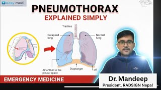 Pneumothorax in ONE Shot | MBBS ,USMLE & NEET PG High-Yield lPneumothorax X-Ray Findings-Dr.Mandeep