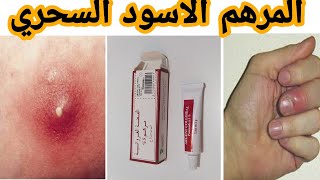 المرهم الاسود السحري في علاج الدوحس والخراج والحبوب  ARGENT COLLOIDAL