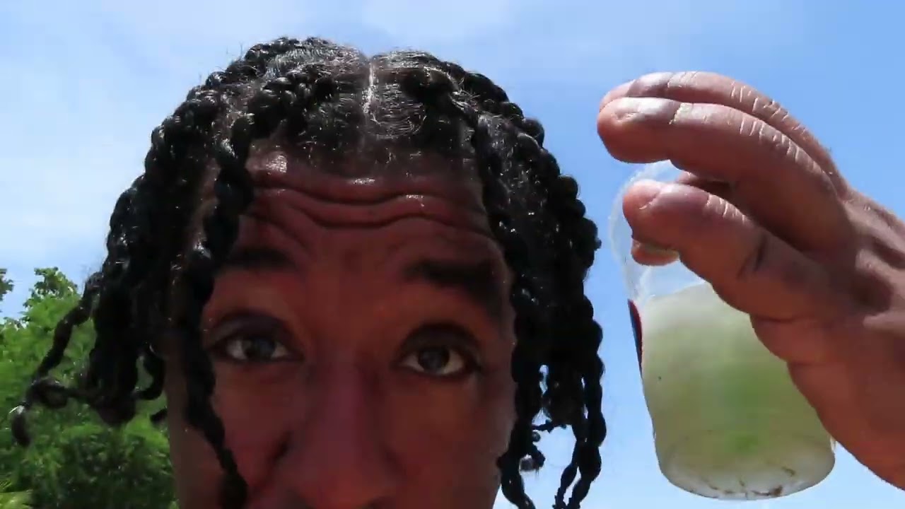 Nuke Vlogs Episode #1 - "My Veneer Story" (Part 1 of 2)