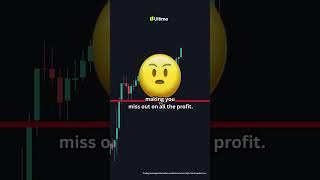 Most Traders Use Stop Loss WRONG | Risk Management Trading Strategy
