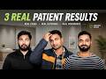 Hair Transplant in Surat (HX-WSIT) | Best Results & Cost of Hair Transplant in Surat