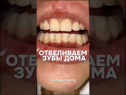 Отбеливание зубов в домашних условиях #здоровье #зож #зубы #польза #отбеливание