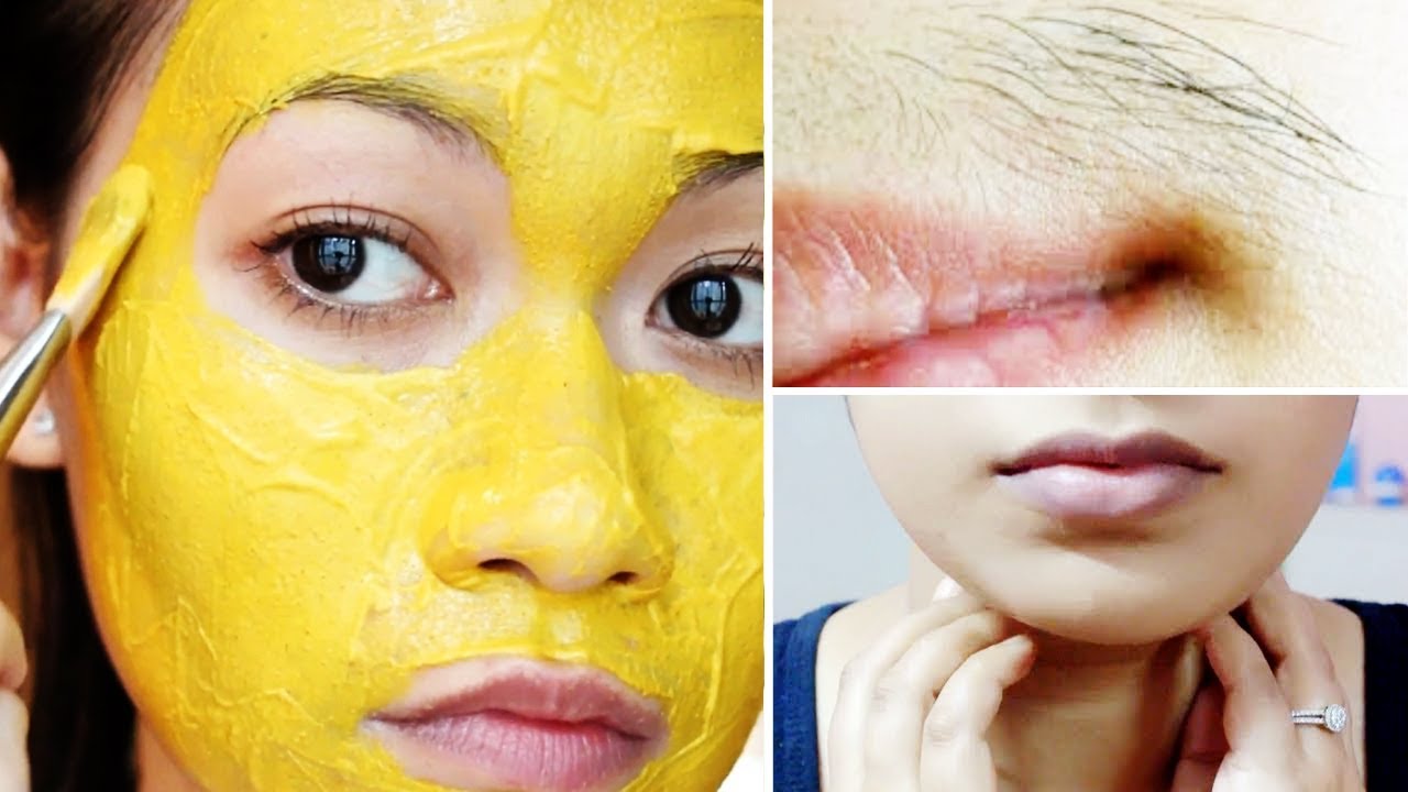 How to Remove Facial Hair Naturally at Home Facial Hair Removal Mask
