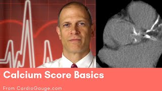 Calcium Score Basics: What the Calcium Score is, and how you can use it to understand your risks.