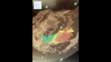 Live 3D Brain Imaging HD