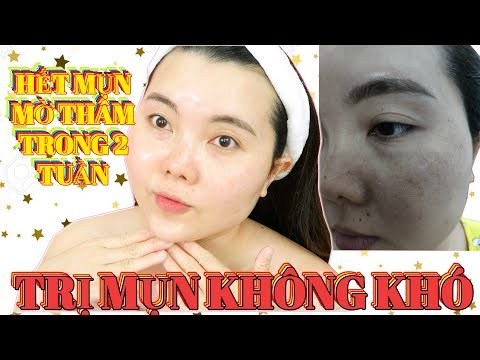 BÍ KÍP NGĂN NGỪA & TRỊ MỤN CHO MỌI LỨA TUỔI