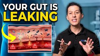 Leaky Gut Explained (and 4 Steps To Fix It)