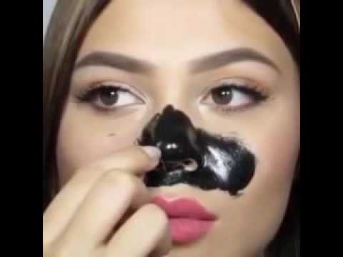 Как удалить следы угрей на лице