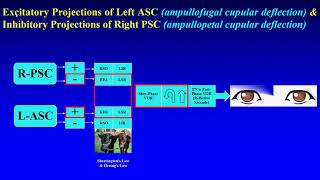 BPPV Posterior Canal (recorded version)