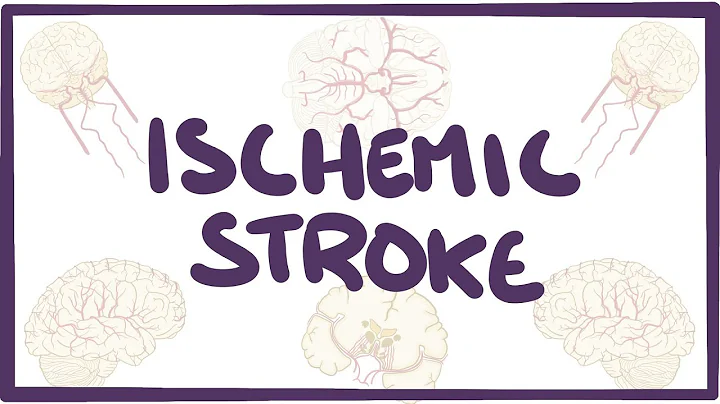 Ischemic Stroke - causes, symptoms, diagnosis, treatment, pathology - DayDayNews