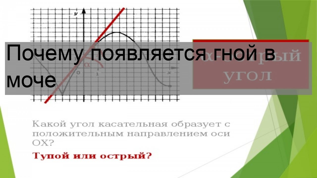 Почему появляется гной в моче - YouTube