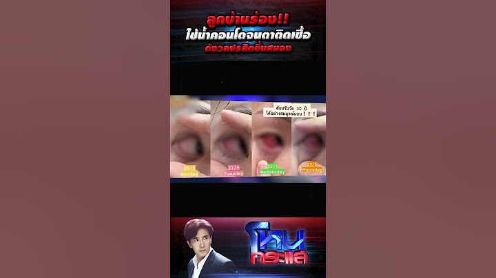 ลูกบ้านร้อง!! ใช้น้ำคอนโดจนตาติดเชื้อ กังวลปรสิตขึ้นสมอง l#โหนกระแส