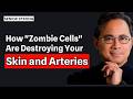 Your Wrinkles Are Actually a Warning Sign About This Vital Organ | Dr. William Li