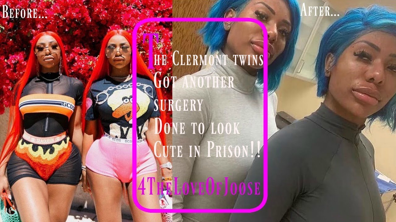 The Clermont Twins get BIGGER LIPS before prison YouTube