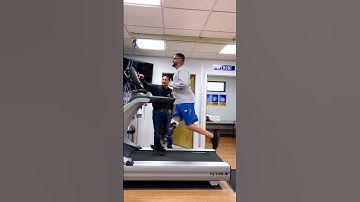Running with a prosthesis | below-knee amputee maxing out the treadmill