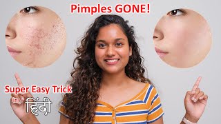 Remove Pimples from your Photos Easy Tips &amp; Tricks 🔥... Chutki mei