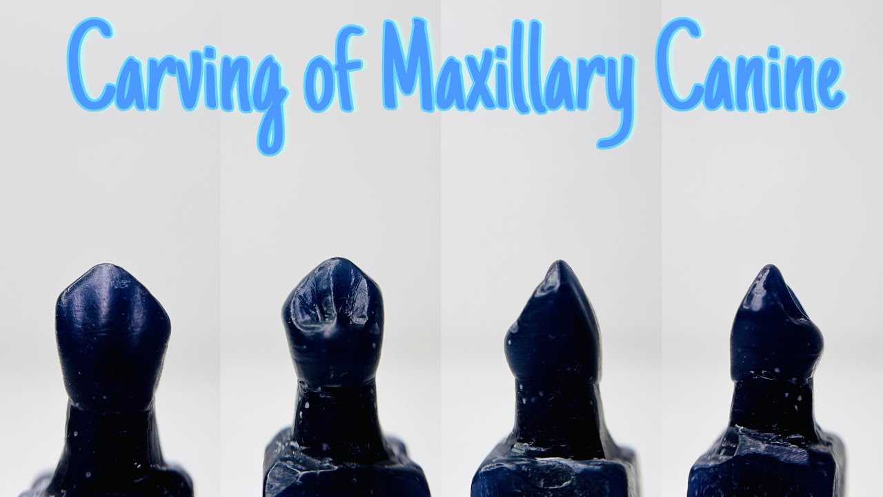 Carving of Maxillary Canine