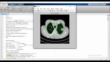 Automatic Lung Segmentation With Juxta-Pleural Nodule Identification using Matlab