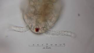 Pond Life Through the Microscope: Copepod 4