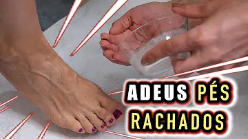 O que fazer para o tênis não machucar o Calcanhar?