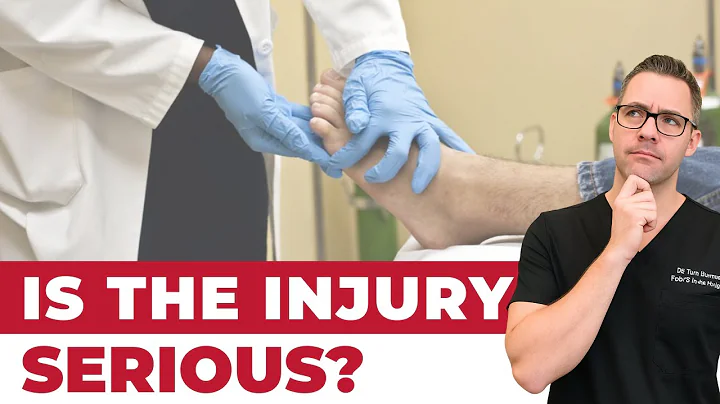 How To Tell If My Foot or Ankle Injury is BAD! [Sprained or BROKEN?]