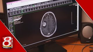 Health Spotlight | Immunotherapy targets brain cancer
