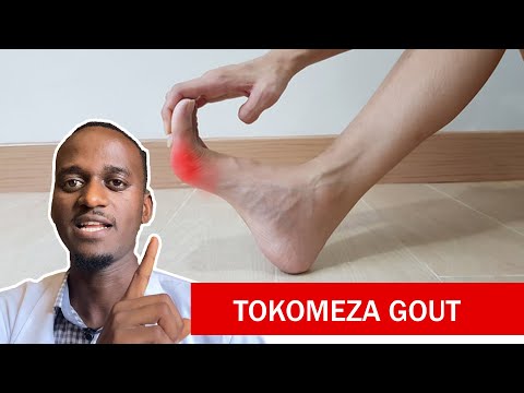 Tiba Kamili Ya GOUT Andaa Nyumbani