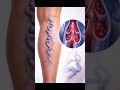 “These visible leg veins could be a warning sign.”#trending #youtubeshorts