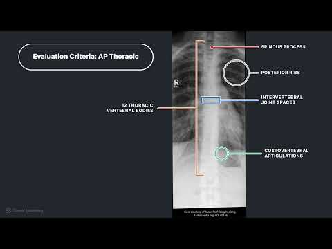 What Is A Thoracolumbar X Ray