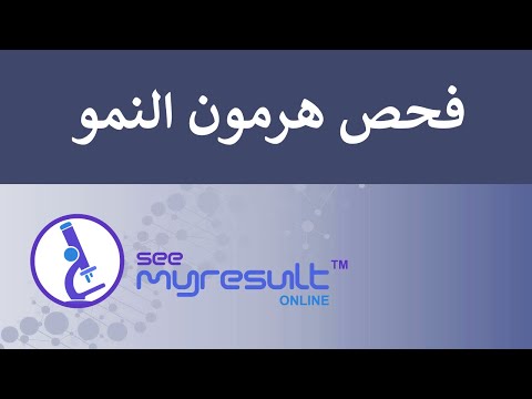 فيديو: من الذي سيحصل على فحص التحفيز في عام 2021؟