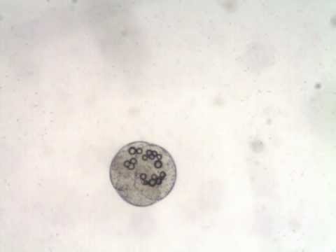 ヤマトカワゴカイの卵を顕微鏡で撮影してみました In 藤前干潟 Youtube