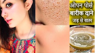 गर्मियों में यह 2 स्टेप्स करें ,Open Pores बारीक दाने जड़ से खत्म  Clean & Clear Soft Whiten Skin