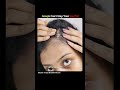 Stop Googling Your Hair Loss! (Do This Instead)