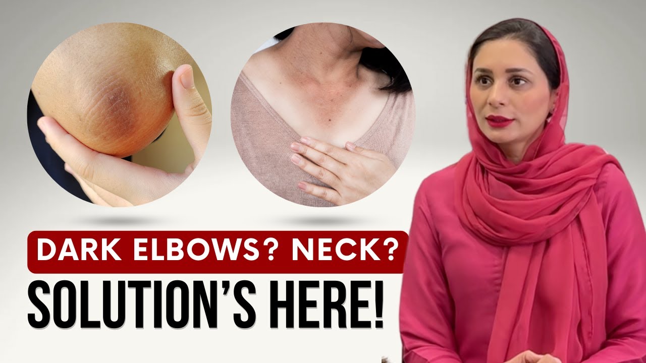 Pigmentation on Neck, Elbows, Knees & Under Arms? Here's the Fix!