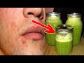 My cousin Did This! JUST 1 CUP OF this Drink At night AND SEE WHAT happens to your body