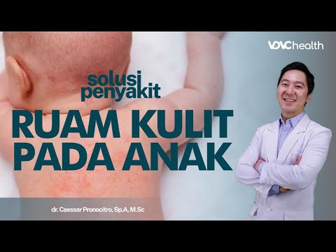 Video: Cara Mengobati Ruam Panas: 14 Langkah (dengan Gambar)