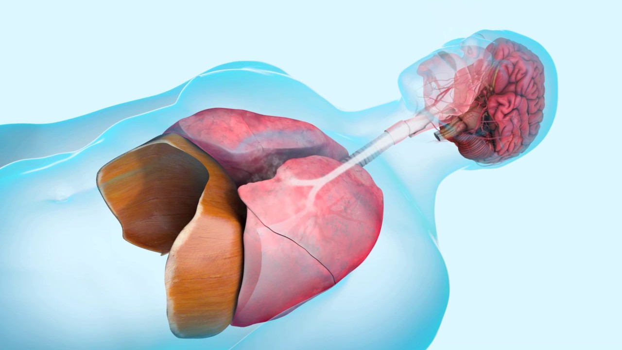 What Causes Sleep Apnea? YouTube