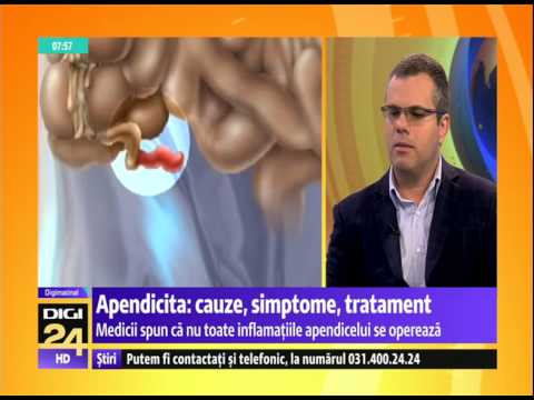 Video: Infiltrarea Apendiculară - Cauze, Simptome, Diagnosticul și Tratamentul Infiltratului Apendicular