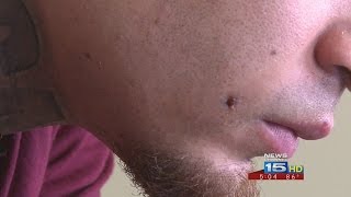 Local rapper shoots himself in face for a music video