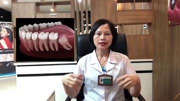 Răng khôn là gì? Khi nào nên nhổ răng khôn? -  Nha khoa Yteeth