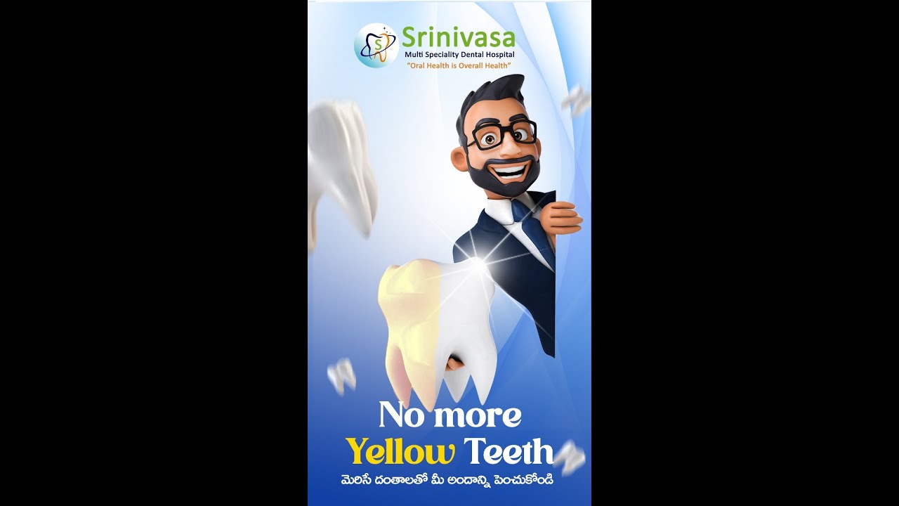 teeth-whitening-srinivasa-multi-speciality-dental-hospital-dr-d-v-s