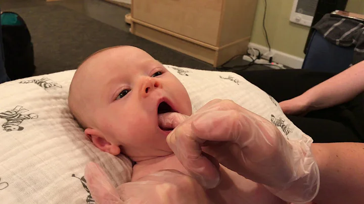 Gentle post-frenotomy care and mouth work by Melis...