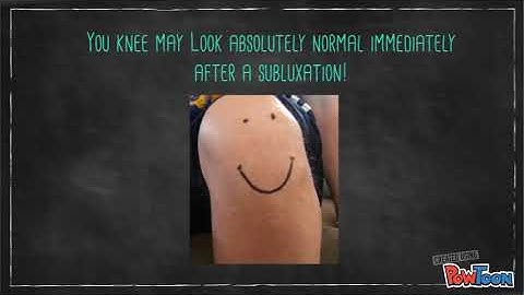 Patellar Instability Patient Education Video