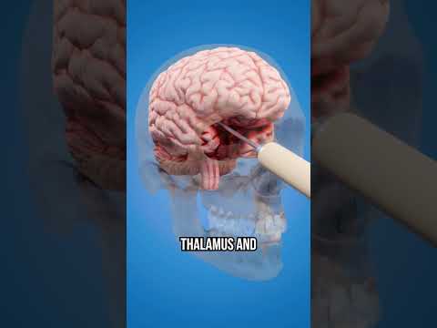 How a Lobotomy