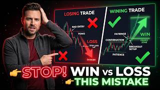 Trade Breakdown (Win vs Loss) Warning: Stop This Mistake