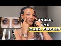 How to get rid of Dark circles under your eye | Causes &amp; quick fixes