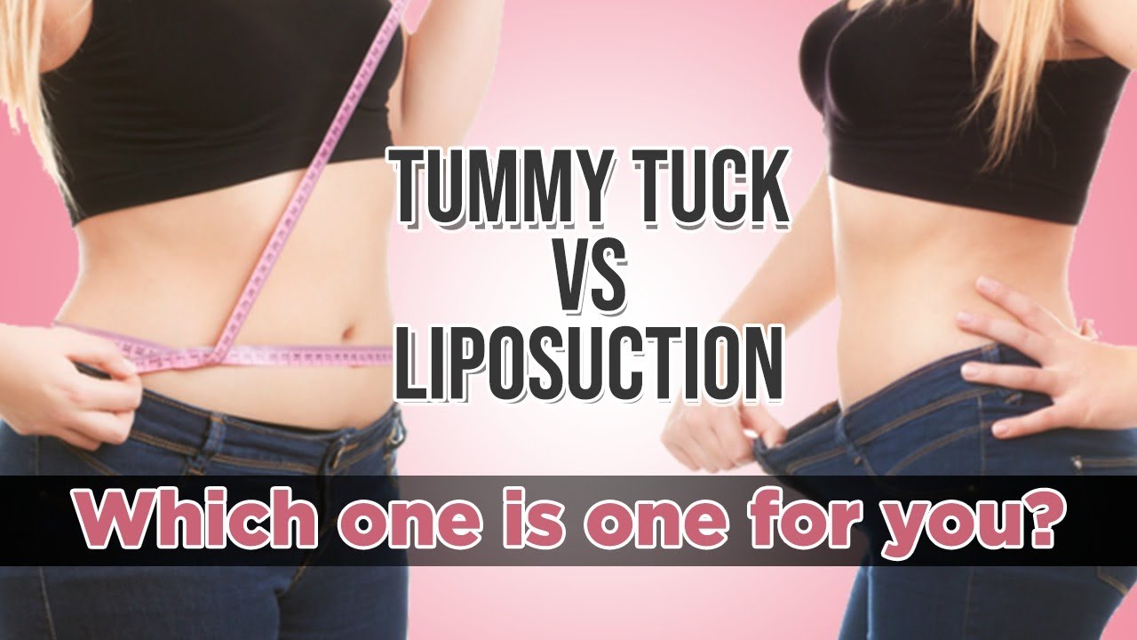 Tummy tuck vs Liposuction, Which one is one for you? Dr.Arjun explains the  differences