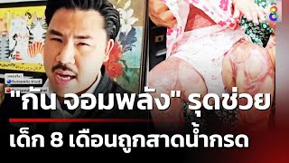 เด็กวัย 8 เดือนถูกเมียคนที่ 2 ของพ่อย่องสาดน้ำกรด | 28 เม.ย. 67 | คุยข่าวเย็นช่อง8